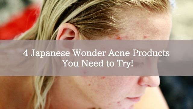 4 Japanese Wonder Acne Products You Need to Try!