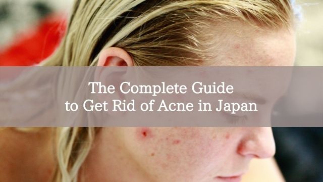 The Complete Guide to Get Rid of Acne in Japan
